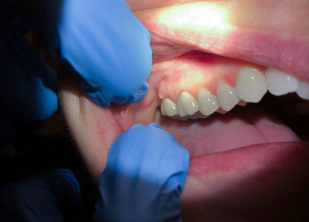 Best Walk-In Emergency Dental Services in Newnan, GA
